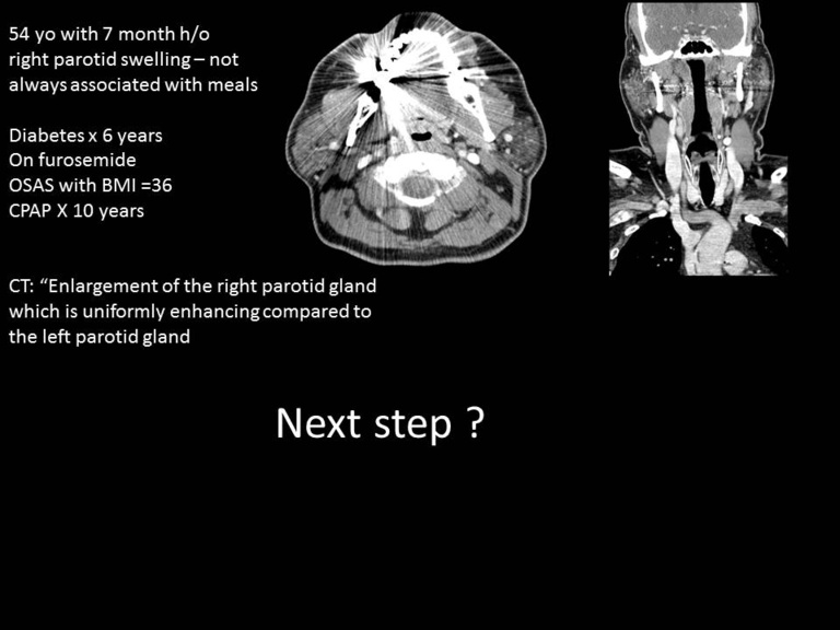 Slide21_1.JPG