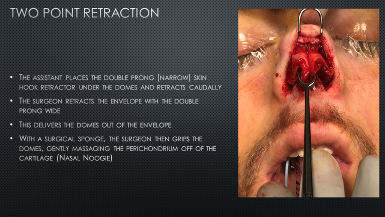 Slide22_0.PNG