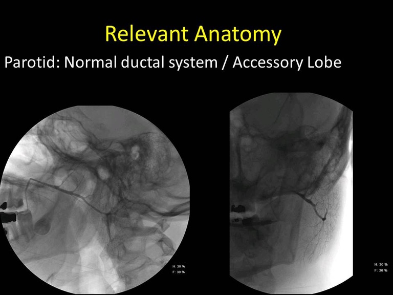 Slide26_1.JPG