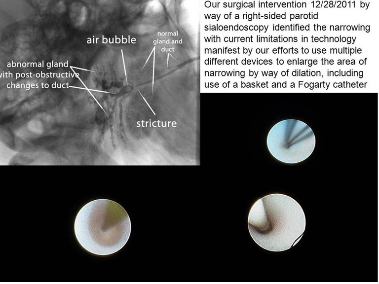 Slide27_0.JPG