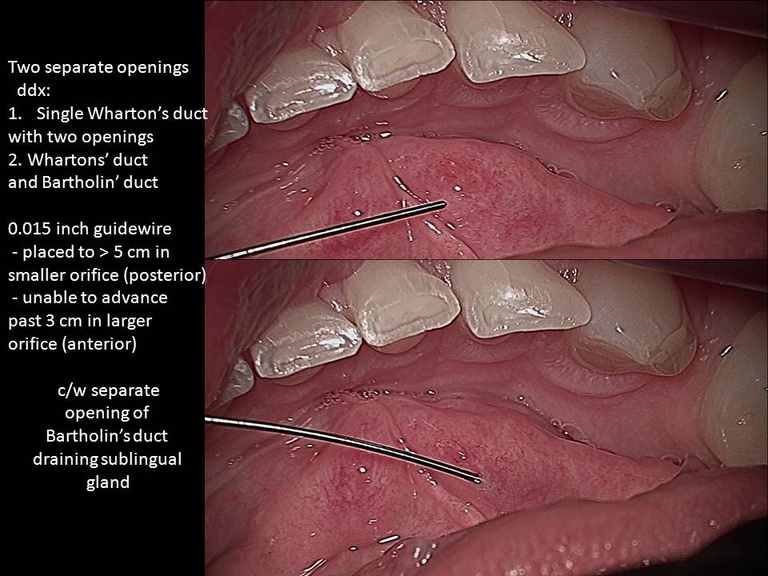 Slide2_0.JPG