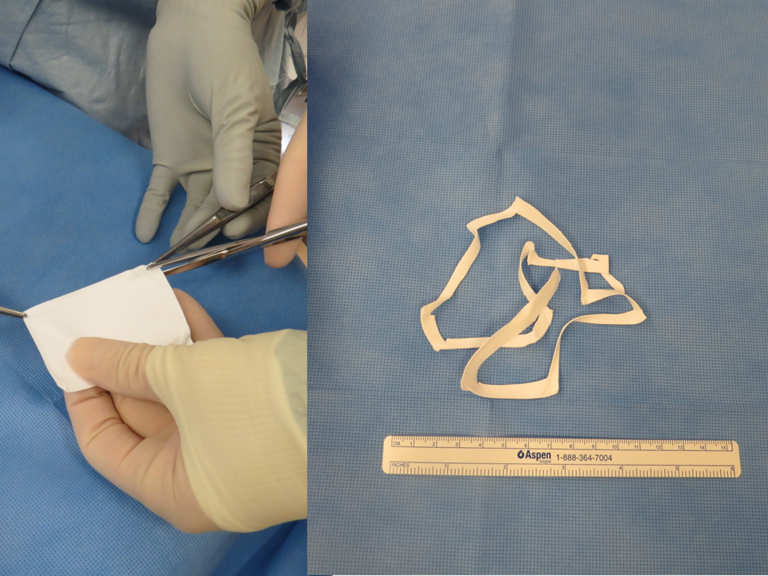 The width of the strip created can vary from thin (1 cm wide) to thicker (2 cm wide)