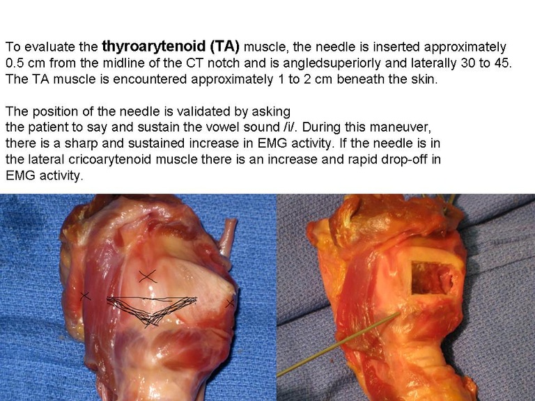 Slide2_12.JPG