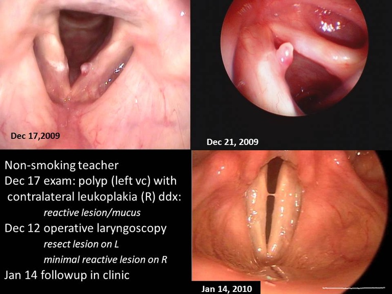 Slide2_15.JPG