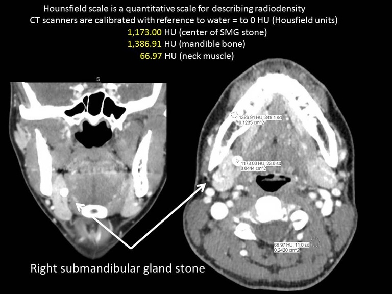 Slide2_2.JPG
