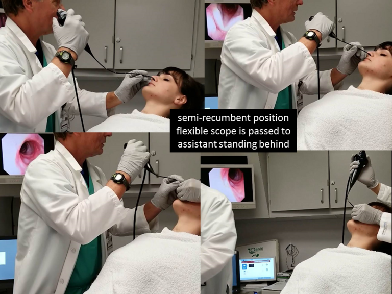 Positioning and placement of flexible scope
