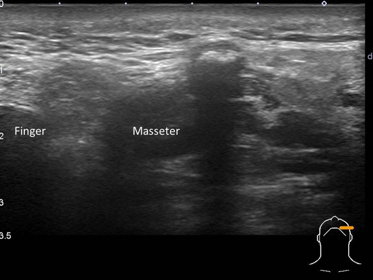 Slide2_45.JPG