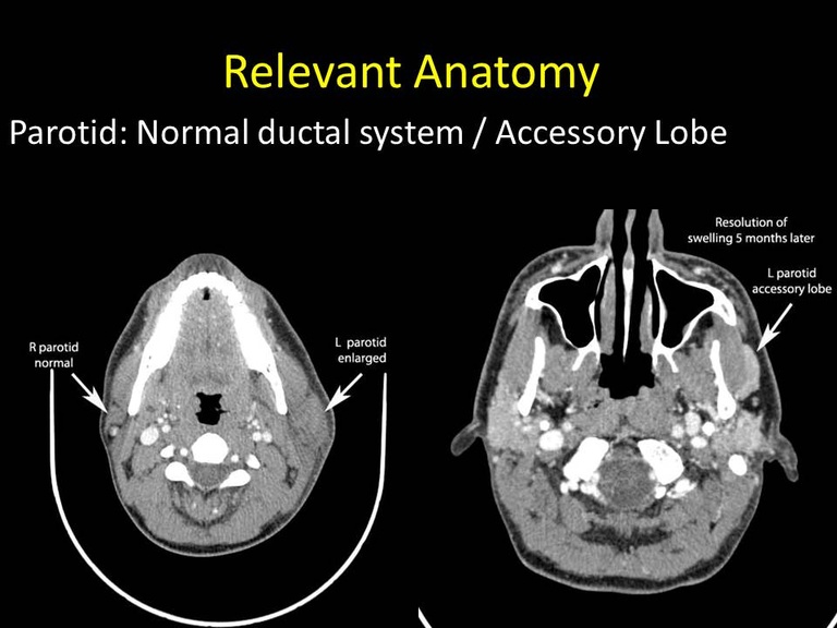 Slide31_1.JPG