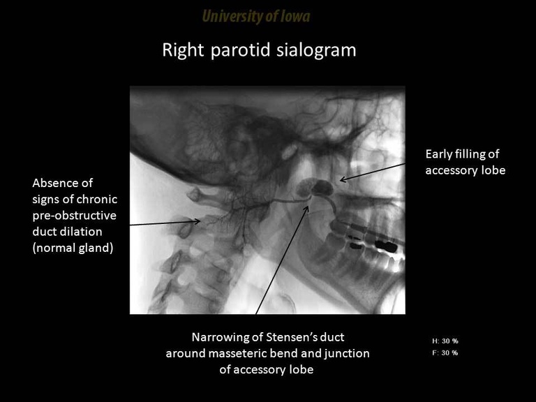 Slide35_1.JPG