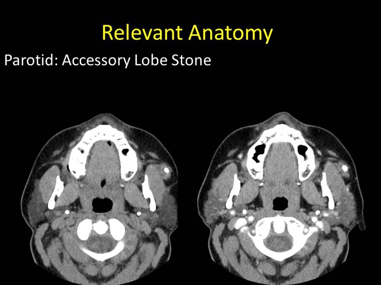 Slide36_1.JPG