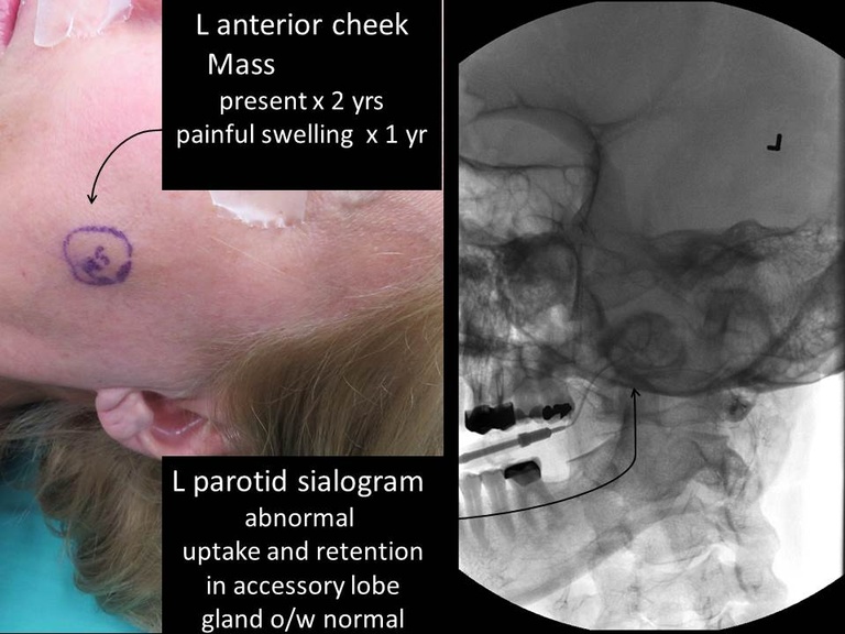 Slide39_1.JPG