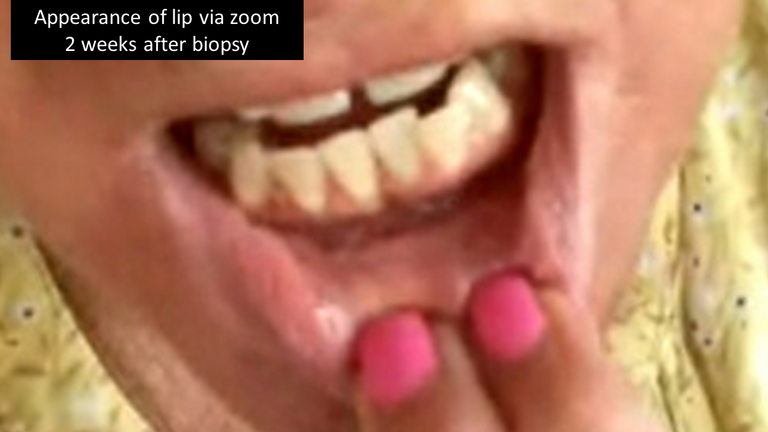 Slide3_108.PNG