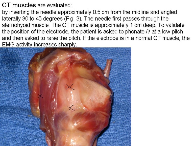 Slide3_11.JPG