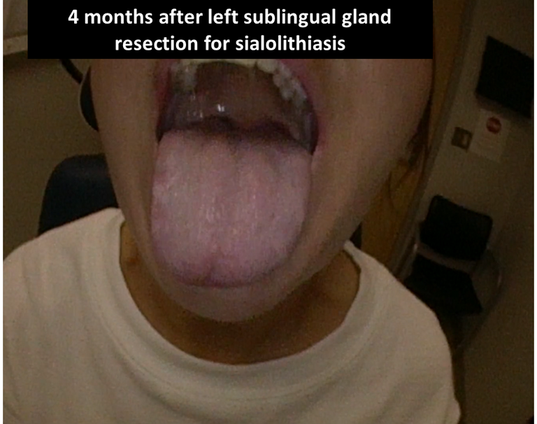 Slide3_118.PNG
