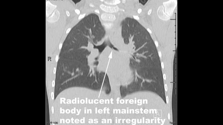 Slide3_125.PNG