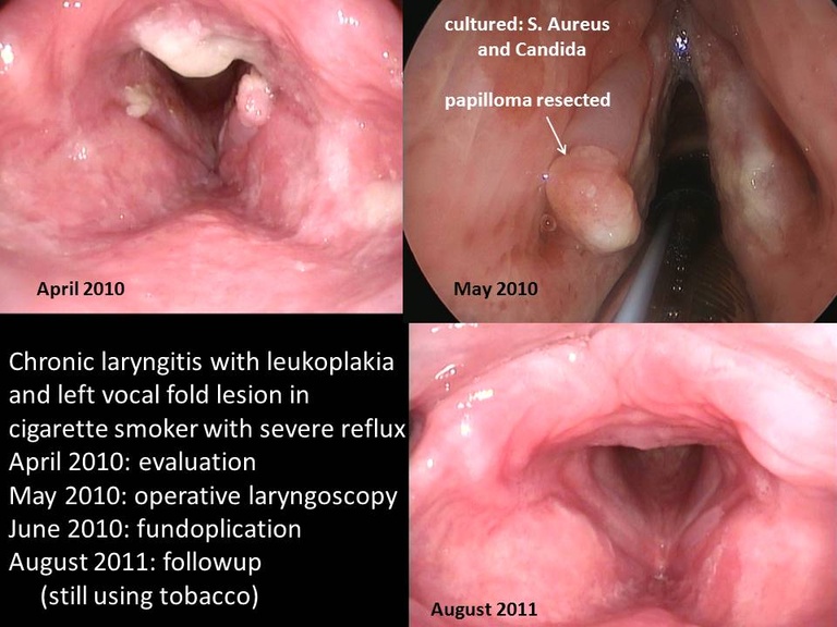 Slide3_14.JPG