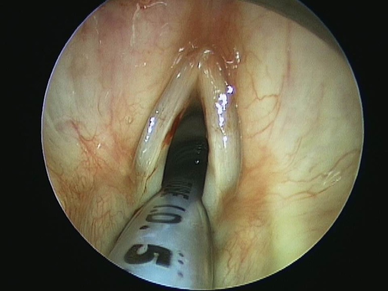 Slide3_22.JPG