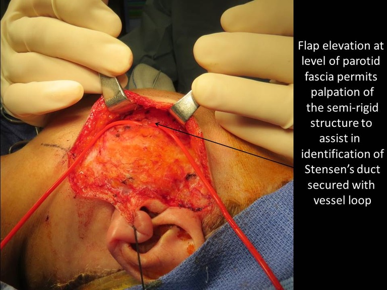 Slide43_0.JPG