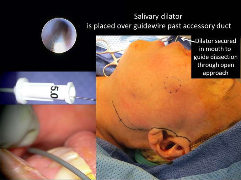 Slide44_0.JPG