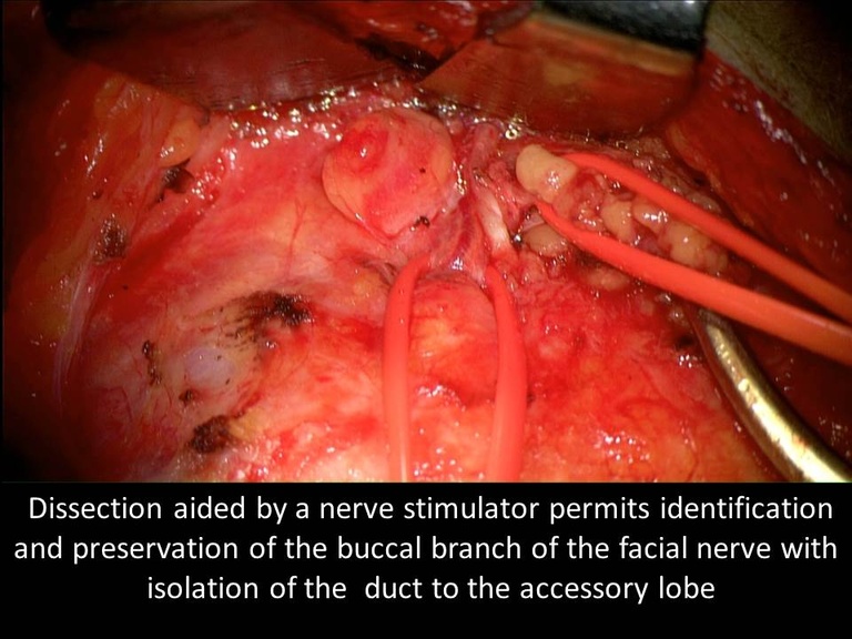 Slide45_1.JPG