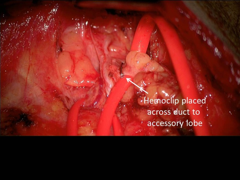 Slide47_0.JPG