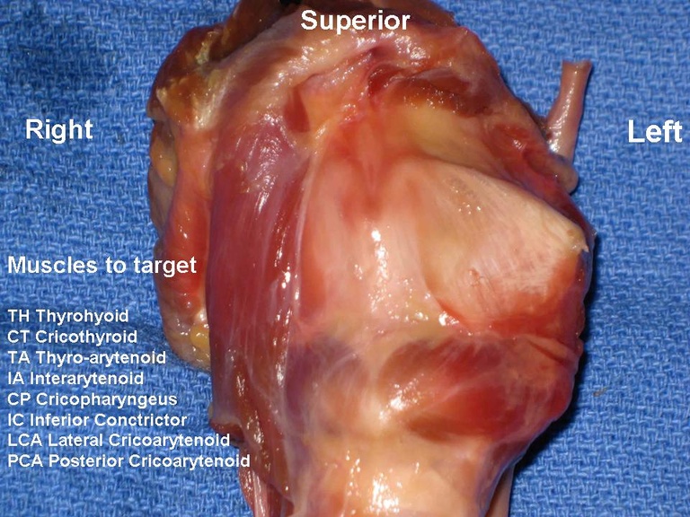 Slide4_11.JPG