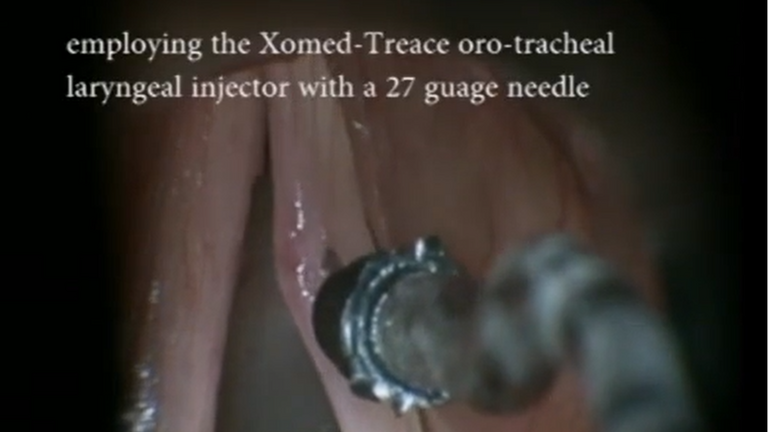 Resection vocal cord lesion with suture orientation