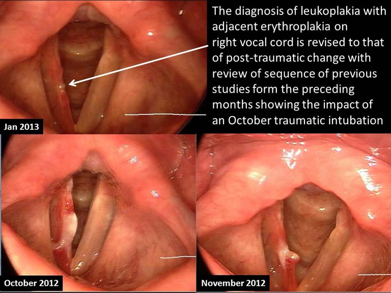 Slide4_13.JPG