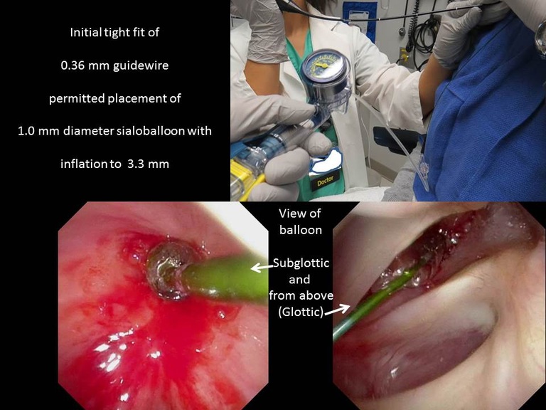 Slide5_21.JPG