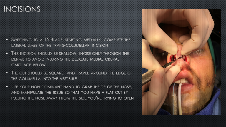 Slide5_25.PNG
