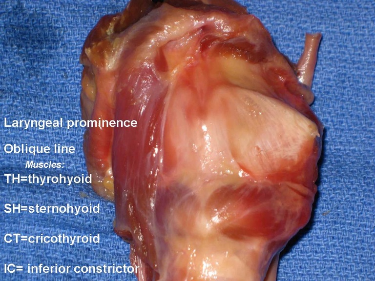 Slide5_8.JPG