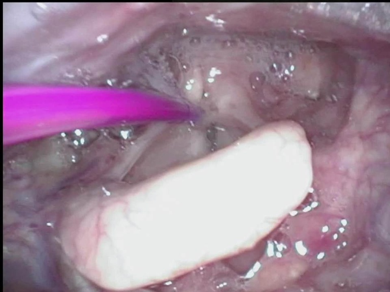Slide6_15.JPG