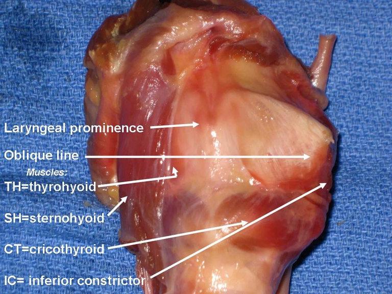 Slide6_6.JPG