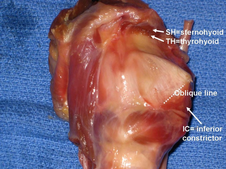 Slide7_2.JPG