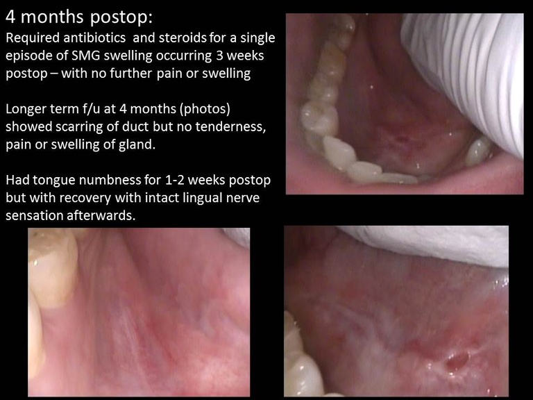 Slide7_8.JPG