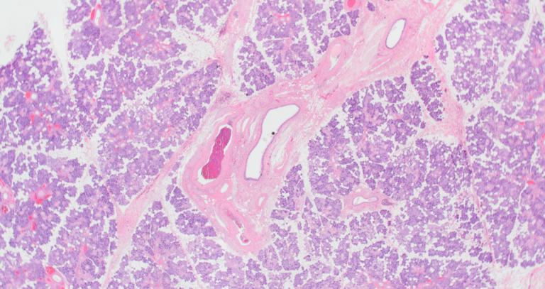 Submand 12.5 x png.png
