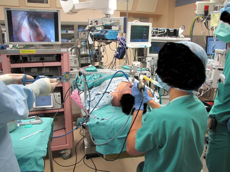  room set up with endoscopy during balloon dilation