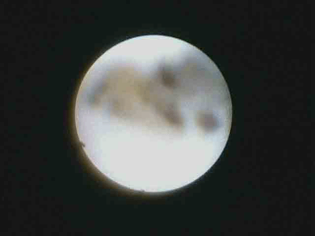 final%20view%20of%20hilum%20copy.gif