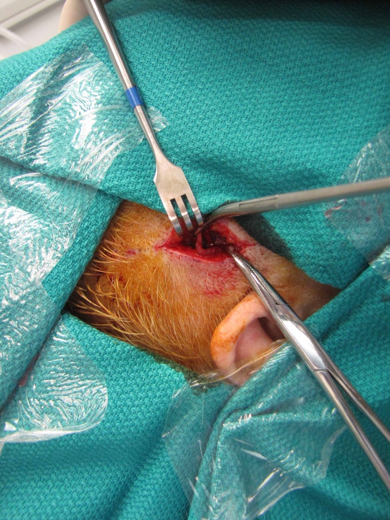 iii.To reduce the risk of frontalis paralysis, biopsy the parietal branch (rather than the frontal branch) of the superficial temporal artery as pictured 