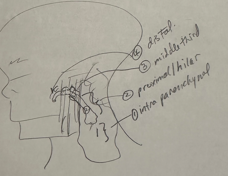 parotid diagram 09272024.png