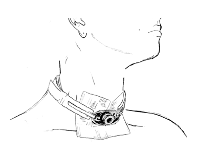 Tracheostomy Velcro Tube Holder