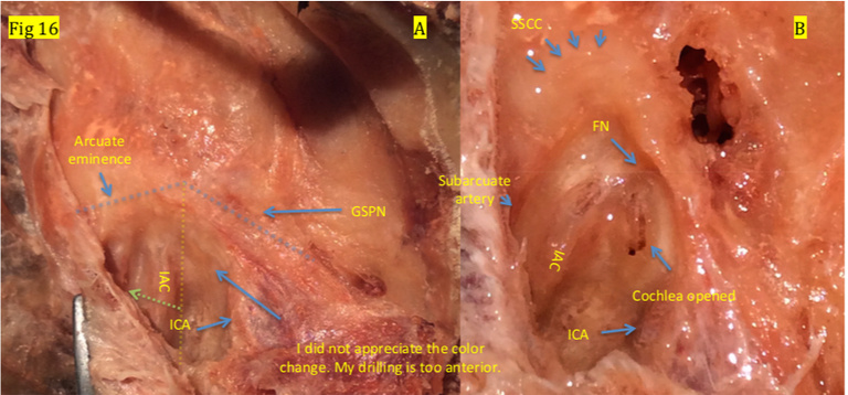 FIgure 16.jpg