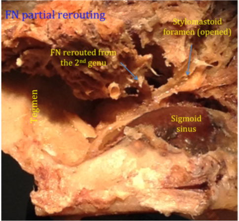 Figure 11C.jpg