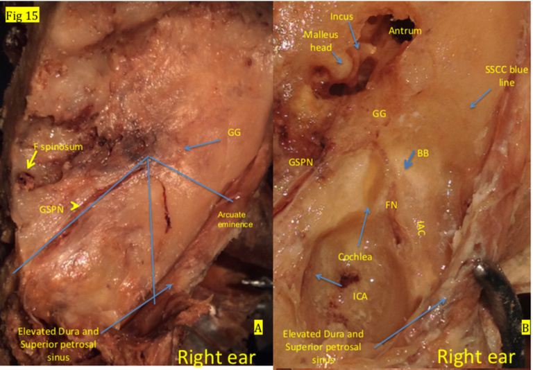 Figure 15 A and B