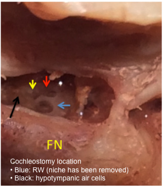 Figure 17