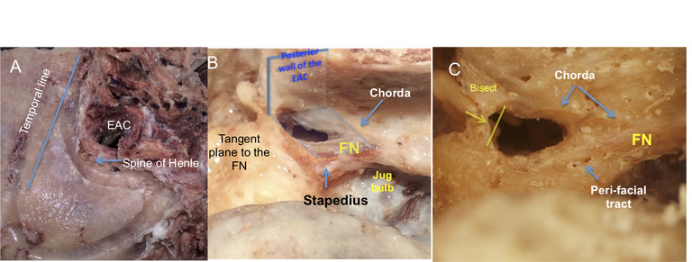 Figure 4 A, B and C.jpg