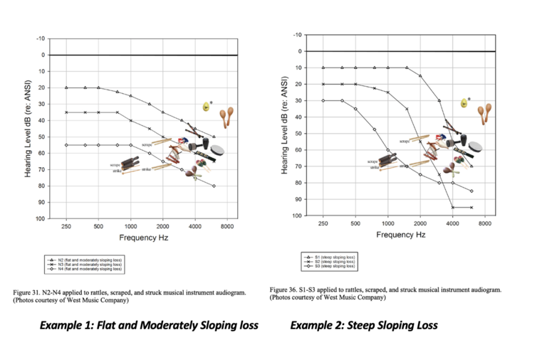 Hearing loss charts Hearing loss charts