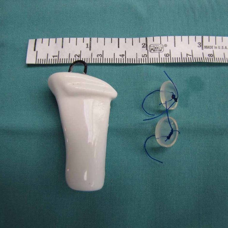 01%20Montgomery%20stent.jpg