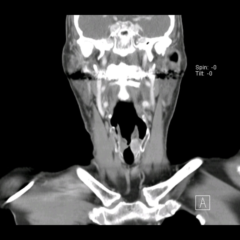 010%20coronal.jpg