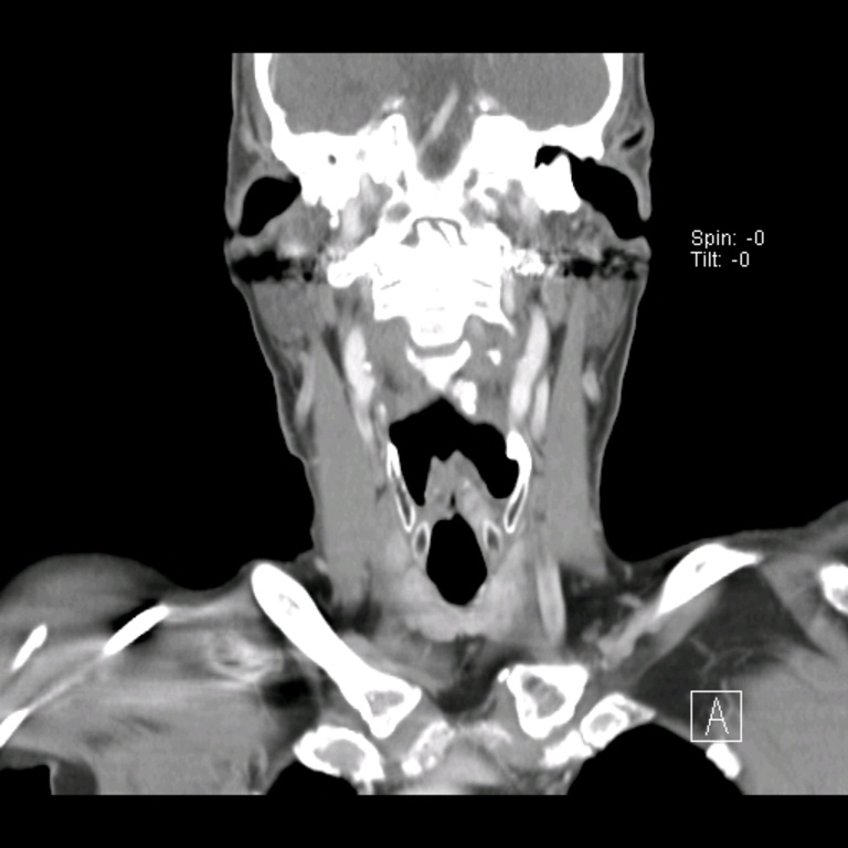 012%20coronal.jpg